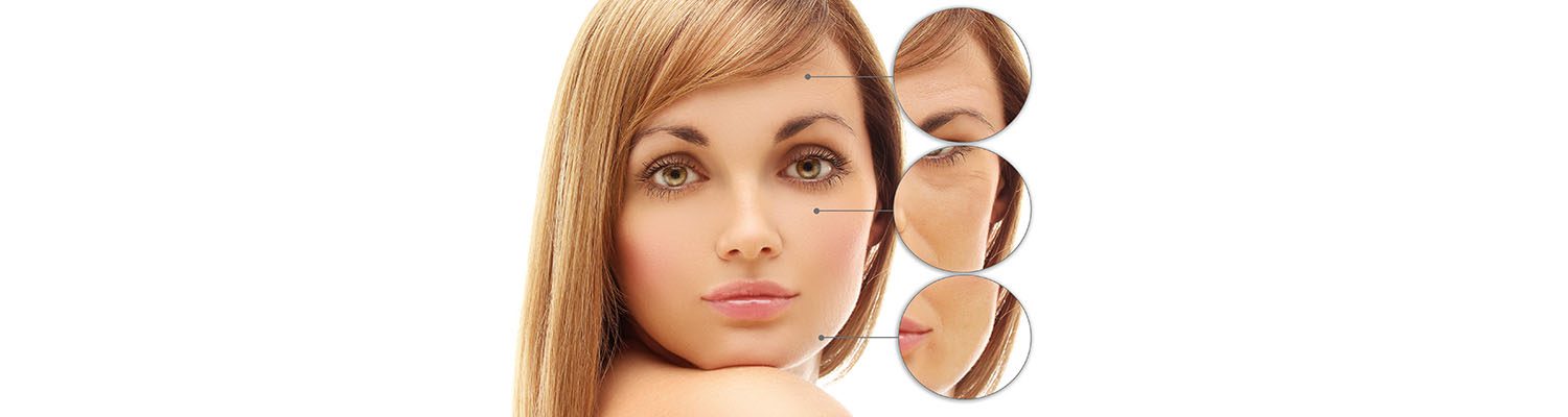 anti wrinkle injections