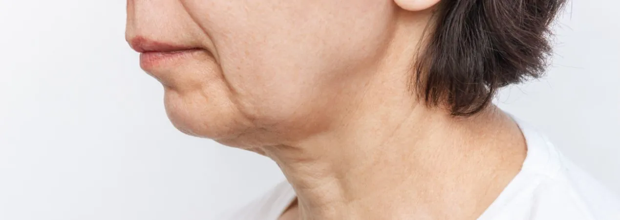 weak-jaw-receding-chin-bank-medispa-medical-aesthetics-skin-care