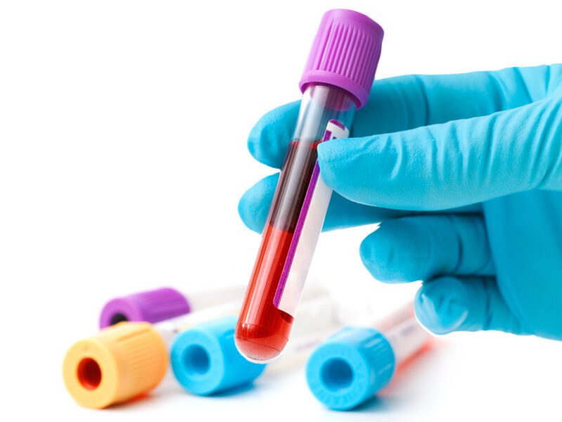 private blood tests cheshire